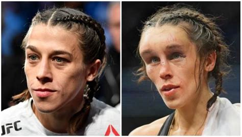 joanna jedrzejczyk implants|Joanna Jedrzejczyk Plastic Surgery: Before and After。